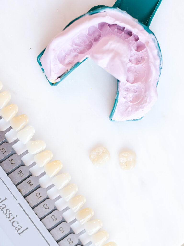 How Long Do Veneers Last?