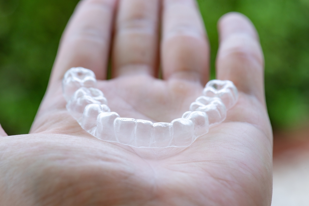 Are Invisalign Results Permanent? Dentist in Hudson, OH. Dr. Leah Divito. Luminous Dental